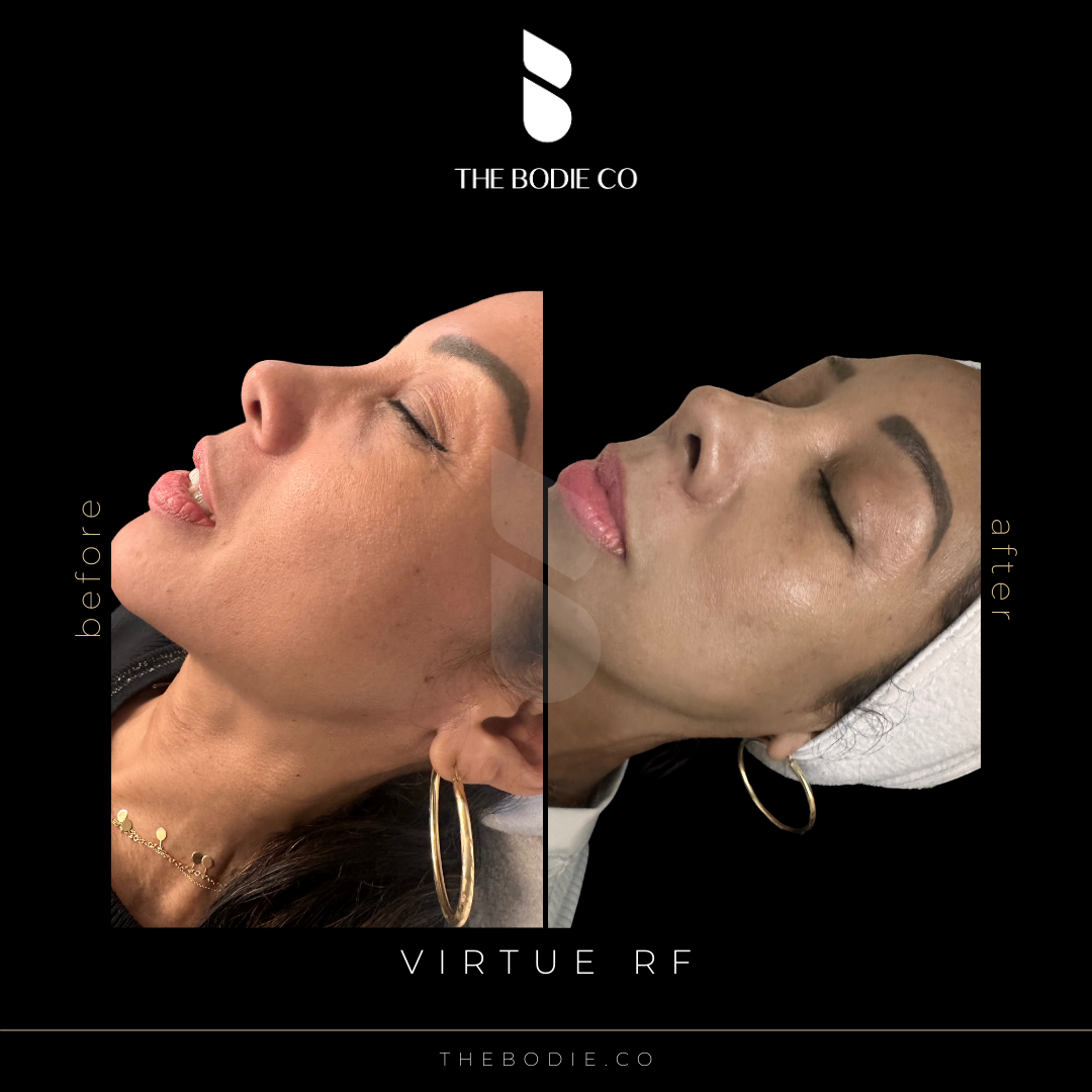 Virtue6